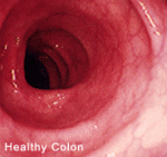 healthy-colon